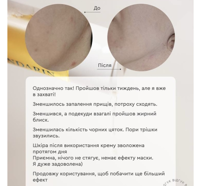 Гель мус для проблемної шкіри обличчя