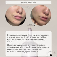 Гель мус для проблемної шкіри обличчя Гель мус для проблемної шкіри обличчя