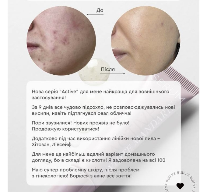 Гель мус для проблемної шкіри обличчя